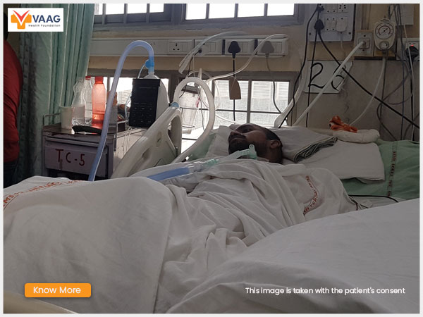 Devesh is a patient with a spinal cord injury